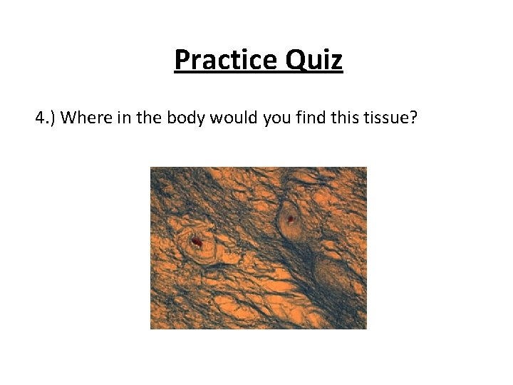 Practice Quiz 4. ) Where in the body would you find this tissue? 