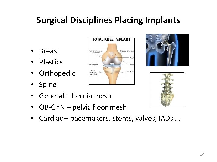 Surgical Disciplines Placing Implants • • Breast Plastics Orthopedic Spine General – hernia mesh Surgical Disciplines Placing Implants • • Breast Plastics Orthopedic Spine General – hernia mesh