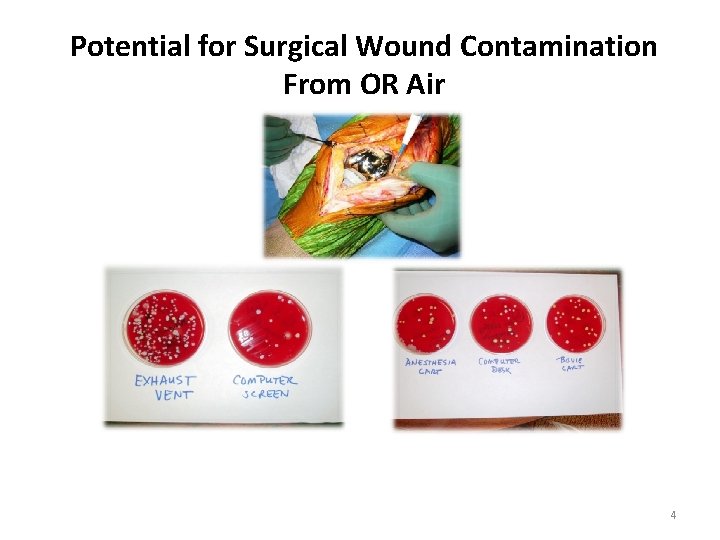 Potential for Surgical Wound Contamination From OR Air 4 Potential for Surgical Wound Contamination From OR Air 4