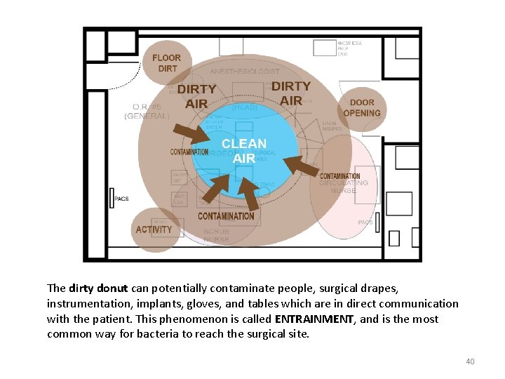 The dirty donut can potentially contaminate people, surgical drapes, instrumentation, implants, gloves, and tables The dirty donut can potentially contaminate people, surgical drapes, instrumentation, implants, gloves, and tables