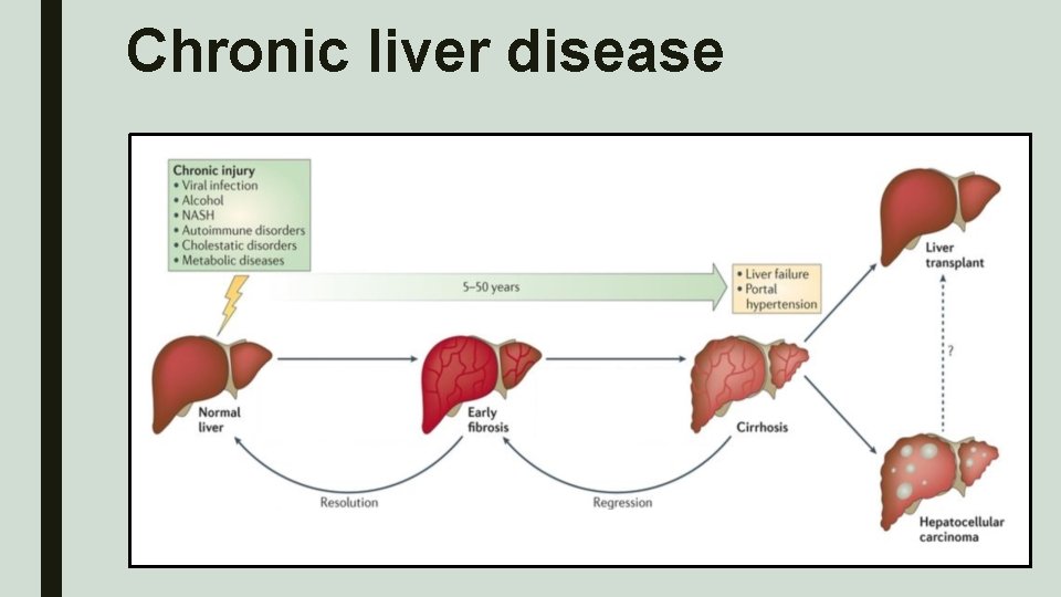 Chronic liver disease 