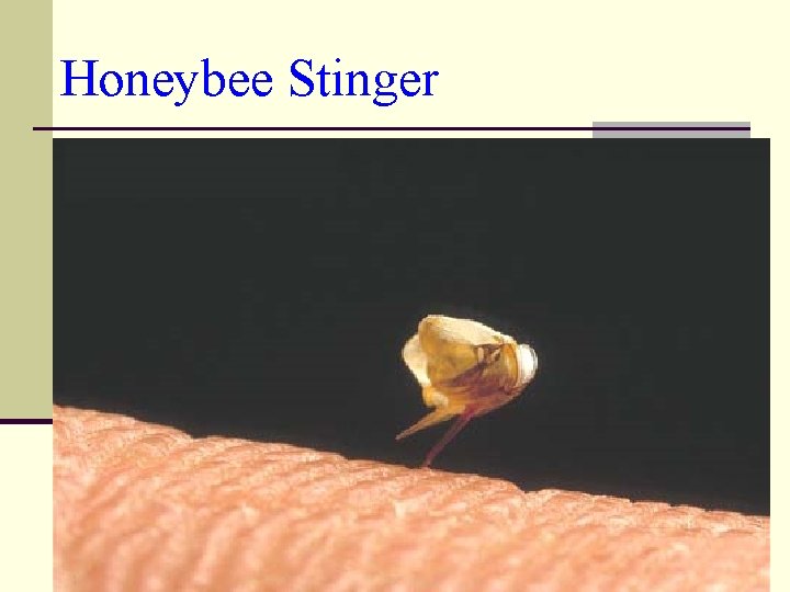 Honeybee Stinger 