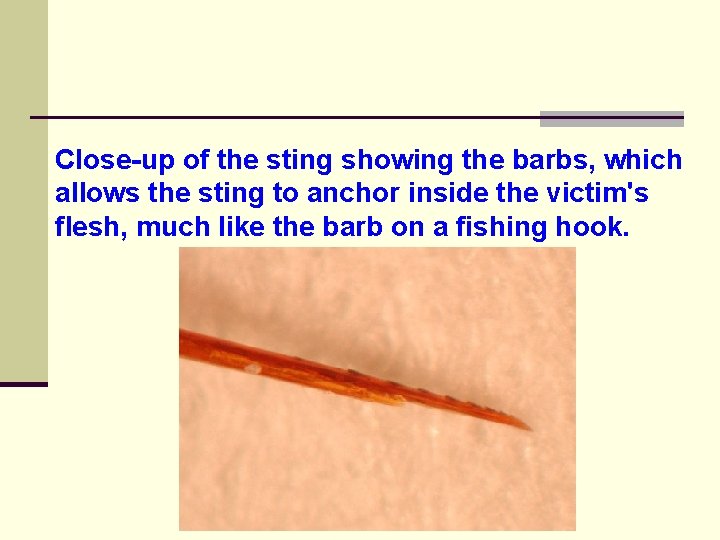 Close-up of the sting showing the barbs, which allows the sting to anchor inside