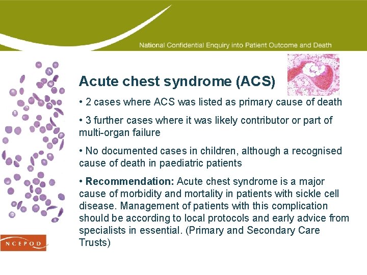 Acute chest syndrome (ACS) • 2 cases where ACS was listed as primary cause