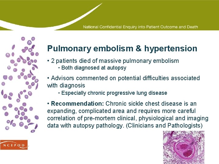 Pulmonary embolism & hypertension • 2 patients died of massive pulmonary embolism • Both