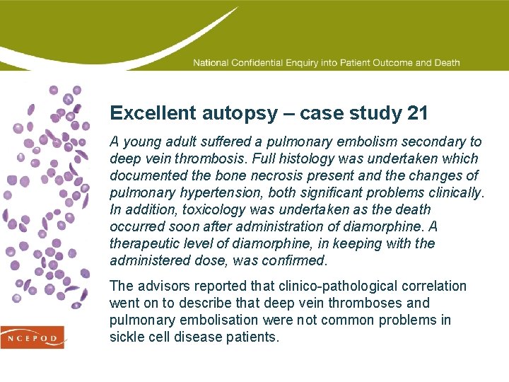 Excellent autopsy – case study 21 A young adult suffered a pulmonary embolism secondary