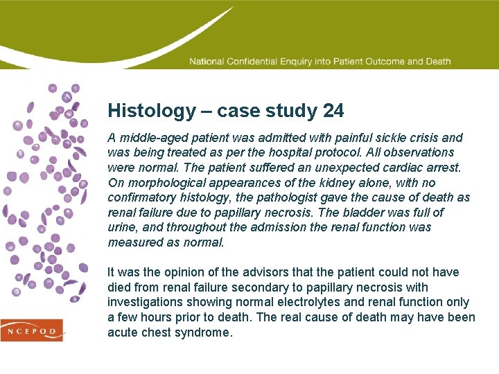 Histology – case study 24 A middle-aged patient was admitted with painful sickle crisis