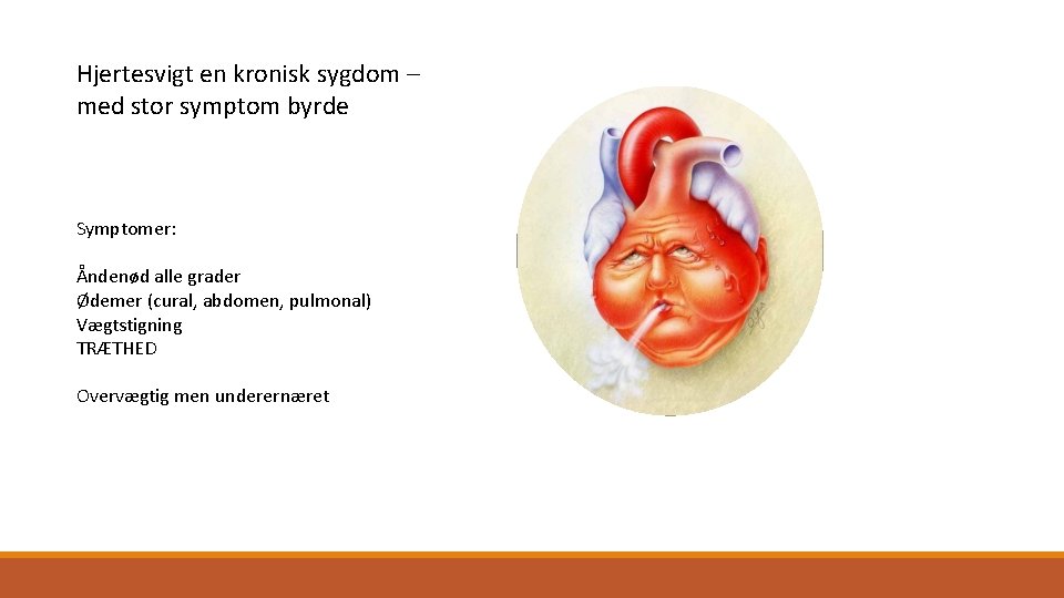 Hjertesvigt en kronisk sygdom – med stor symptom byrde Symptomer: Åndenød alle grader Ødemer