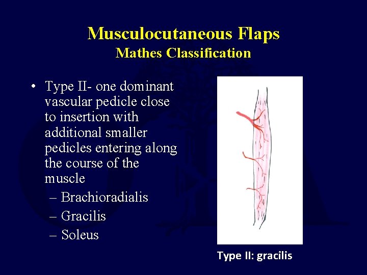 Musculocutaneous Flaps Mathes Classification • Type II- one dominant vascular pedicle close to insertion