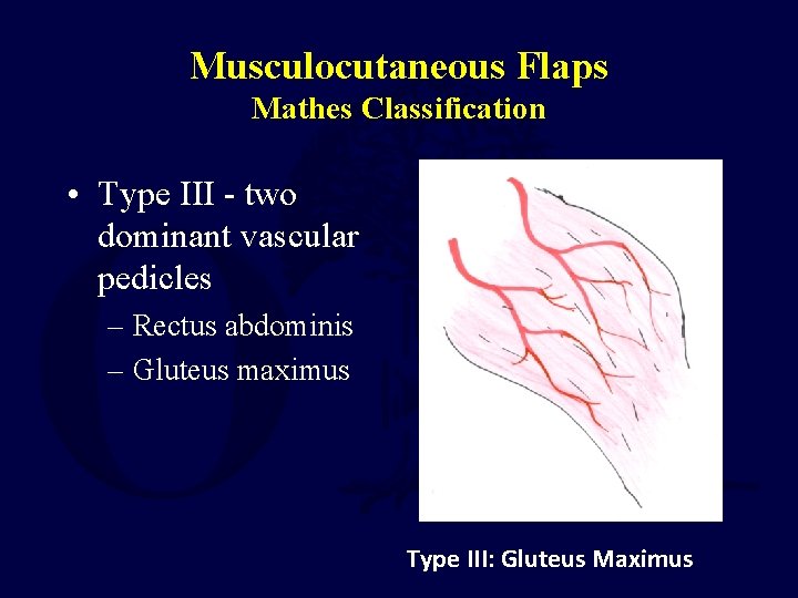 Musculocutaneous Flaps Mathes Classification • Type III - two dominant vascular pedicles – Rectus