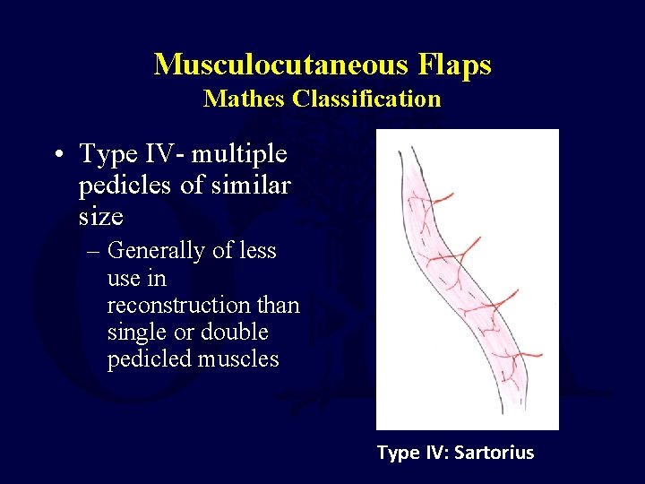 Musculocutaneous Flaps Mathes Classification • Type IV- multiple pedicles of similar size – Generally