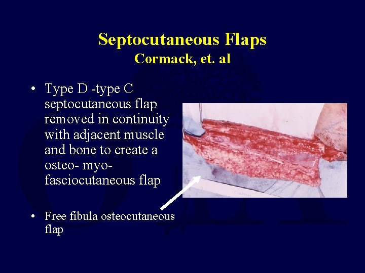 Septocutaneous Flaps Cormack, et. al • Type D -type C septocutaneous flap removed in