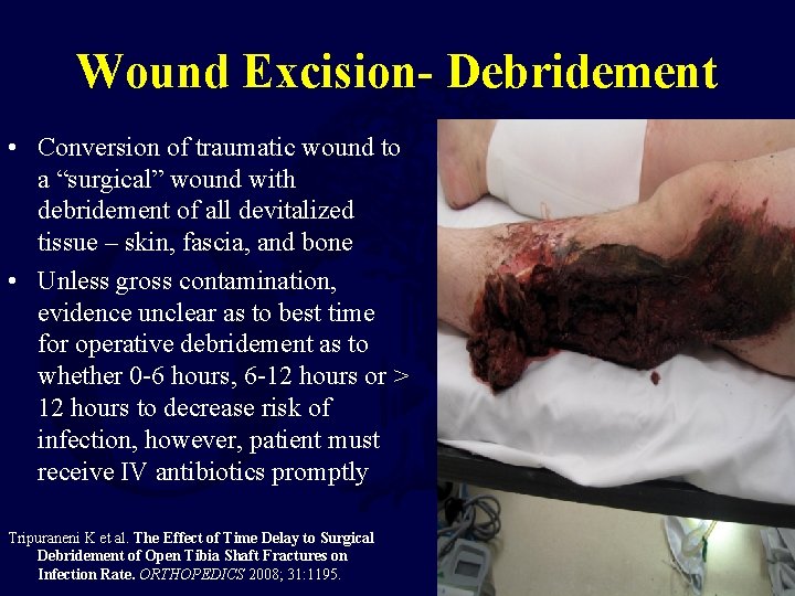 Wound Excision- Debridement • Conversion of traumatic wound to a “surgical” wound with debridement