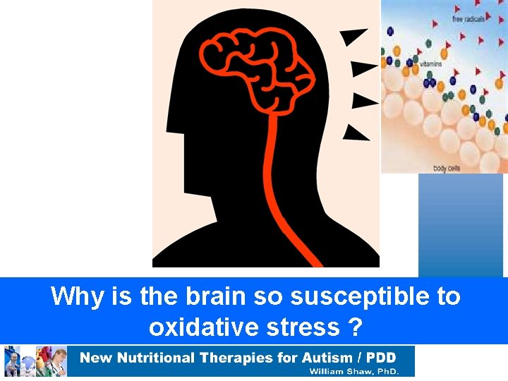 Why is the brain so susceptible to oxidative stress ? 
