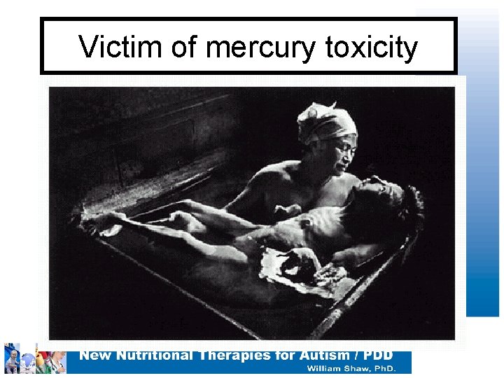 Victim of mercury toxicity 