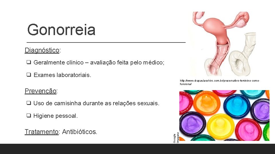 Gonorreia Diagnóstico: ❑ Geralmente clínico – avaliação feita pelo médico; ❑ Exames laboratoriais. http: Gonorreia Diagnóstico: ❑ Geralmente clínico – avaliação feita pelo médico; ❑ Exames laboratoriais. http: