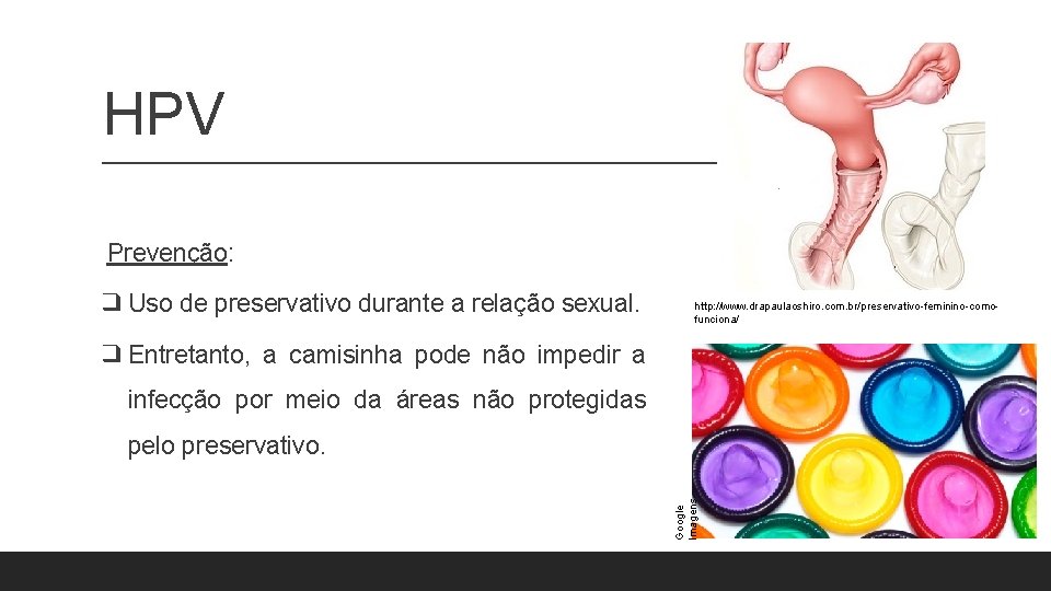 HPV Prevenção: ❑ Uso de preservativo durante a relação sexual. http: //www. drapaulaoshiro. com. HPV Prevenção: ❑ Uso de preservativo durante a relação sexual. http: //www. drapaulaoshiro. com.