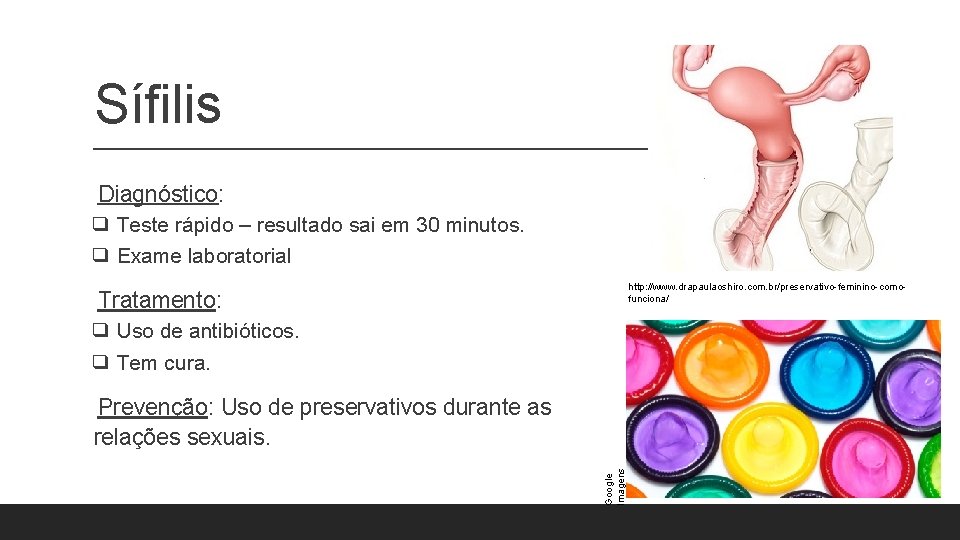 Sífilis Diagnóstico: ❑ Teste rápido – resultado sai em 30 minutos. ❑ Exame laboratorial Sífilis Diagnóstico: ❑ Teste rápido – resultado sai em 30 minutos. ❑ Exame laboratorial