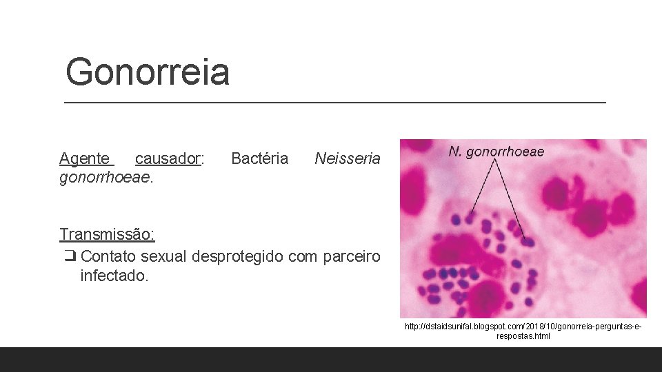 Gonorreia Agente causador: gonorrhoeae. Bactéria Neisseria Transmissão: ❑ Contato sexual desprotegido com parceiro infectado. Gonorreia Agente causador: gonorrhoeae. Bactéria Neisseria Transmissão: ❑ Contato sexual desprotegido com parceiro infectado.