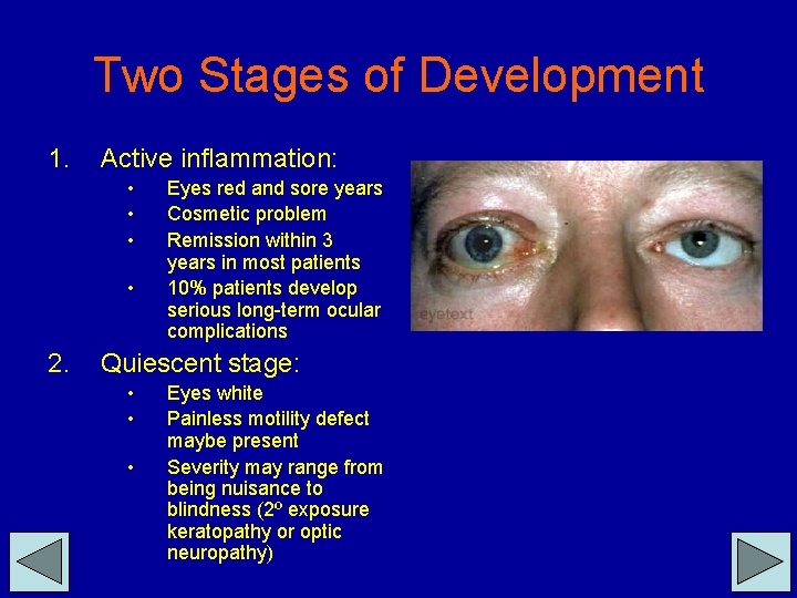 Two Stages of Development 1. Active inflammation: • • 2. Eyes red and sore