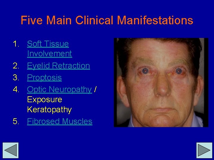Five Main Clinical Manifestations 1. Soft Tissue Involvement 2. Eyelid Retraction 3. Proptosis 4.