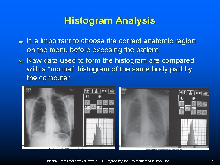 Histogram Analysis It is important to choose the correct anatomic region on the menu