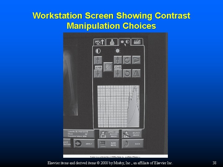 Workstation Screen Showing Contrast Manipulation Choices Elsevier items and derived items © 2008 by