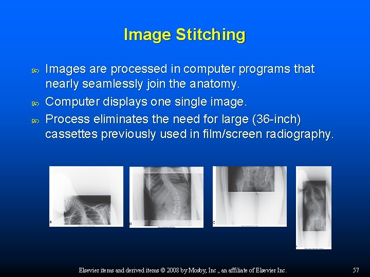 Image Stitching Images are processed in computer programs that nearly seamlessly join the anatomy.