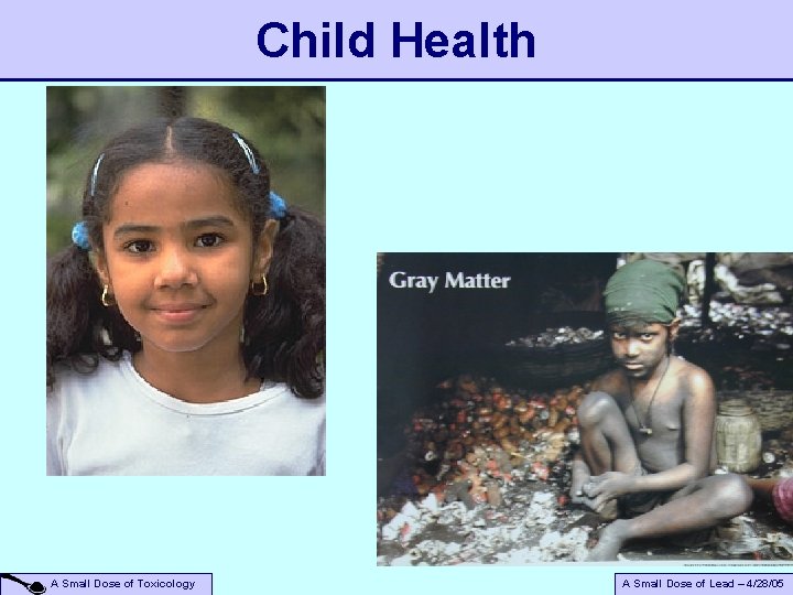Child Health A Small Dose of Toxicology A Small Dose of Lead – 4/28/05