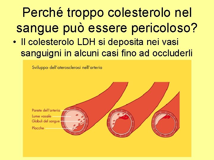 Perché troppo colesterolo nel sangue può essere pericoloso? • Il colesterolo LDH si deposita