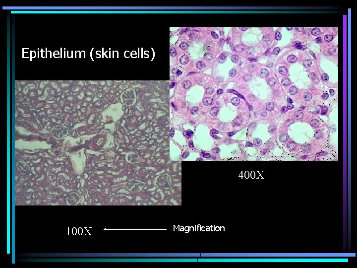 Epithelium (skin cells) 400 X 100 X Magnification 