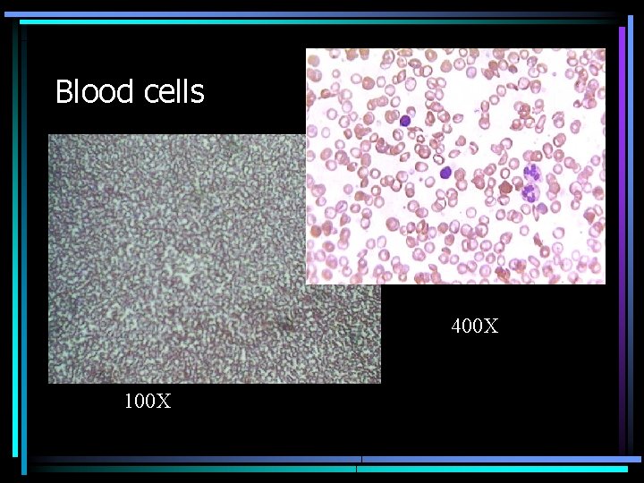 Blood cells 400 X 100 X 