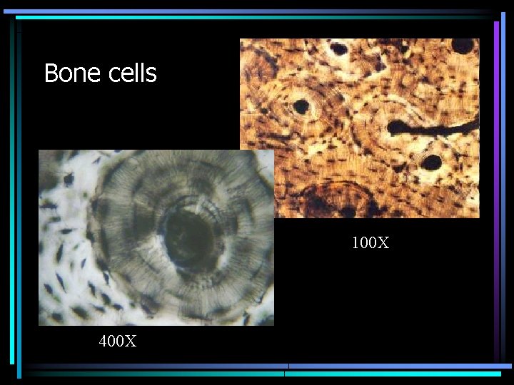 Bone cells 100 X 400 X 