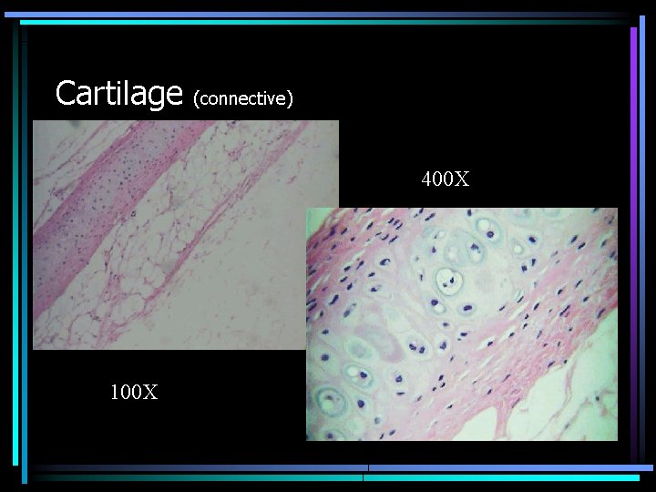 Cartilage (connective) 400 X 100 X 