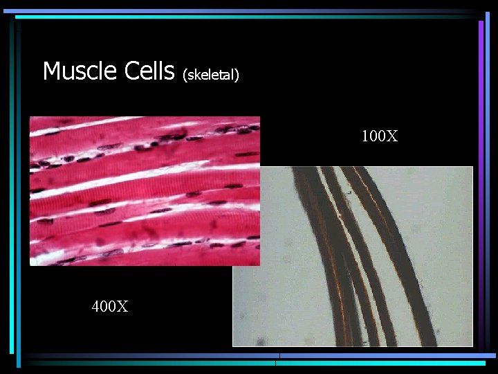 Muscle Cells (skeletal) 100 X 400 X 