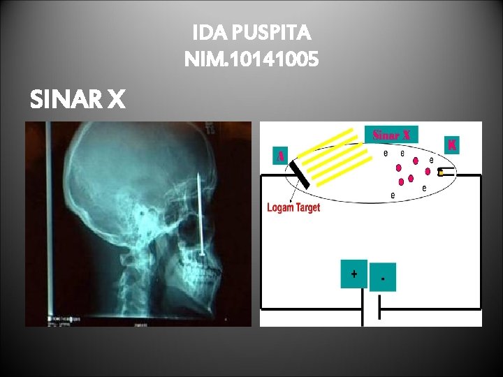 IDA PUSPITA NIM. 10141005 SINAR X 