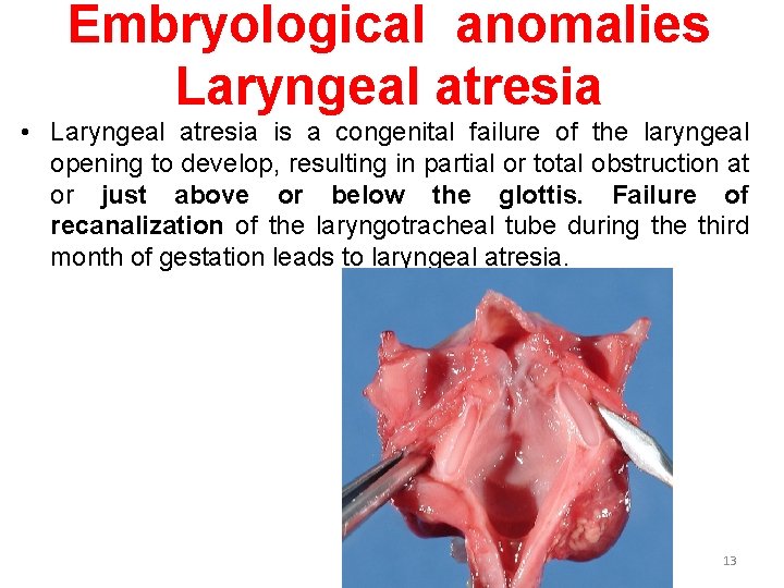 Embryological anomalies Laryngeal atresia • Laryngeal atresia is a congenital failure of the laryngeal Embryological anomalies Laryngeal atresia • Laryngeal atresia is a congenital failure of the laryngeal