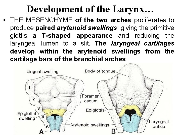 Development of the Larynx… • THE MESENCHYME of the two arches proliferates to produce Development of the Larynx… • THE MESENCHYME of the two arches proliferates to produce