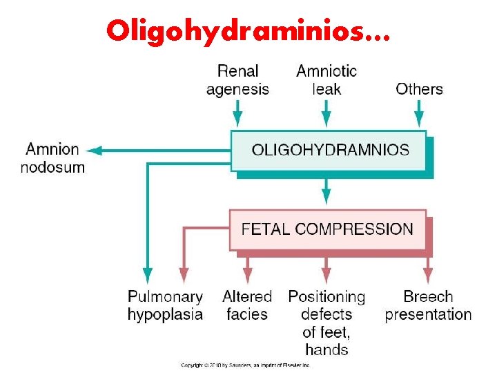 Oligohydraminios… LUFUKUJA G. 39 Oligohydraminios… LUFUKUJA G. 39