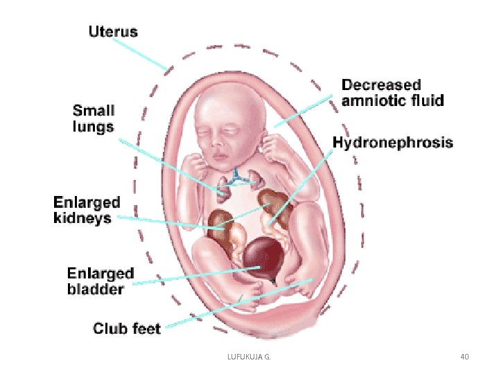 LUFUKUJA G. 40 LUFUKUJA G. 40