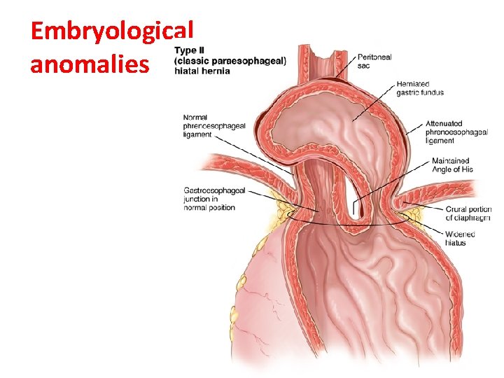 Embryological anomalies LUFUKUJA G. 52 Embryological anomalies LUFUKUJA G. 52