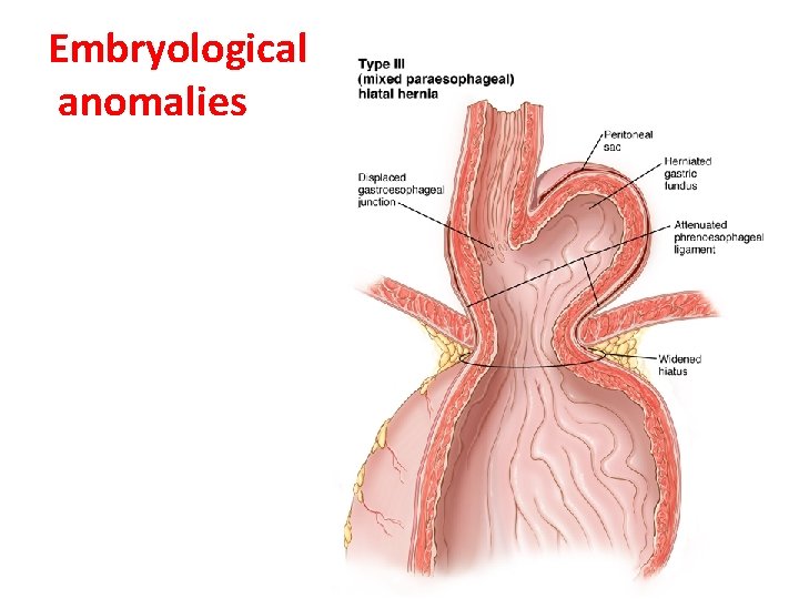 Embryological anomalies LUFUKUJA G. 53 Embryological anomalies LUFUKUJA G. 53