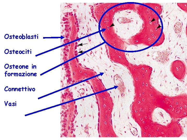 Osteoblasti Osteociti Osteone in formazione Connettivo Vasi 