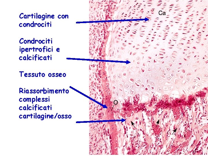 Cartilagine condrociti Condrociti ipertrofici e calcificati Tessuto osseo Riassorbimento complessi calcificati cartilagine/osso 