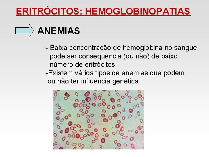 ERITRÓCITOS: HEMOGLOBINOPATIAS ANEMIAS - Baixa concentração de hemoglobina no sangue. pode ser conseqüência (ou ERITRÓCITOS: HEMOGLOBINOPATIAS ANEMIAS - Baixa concentração de hemoglobina no sangue. pode ser conseqüência (ou