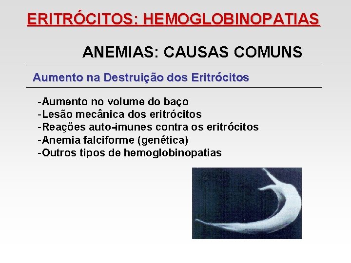 ERITRÓCITOS: HEMOGLOBINOPATIAS ANEMIAS: CAUSAS COMUNS Aumento na Destruição dos Eritrócitos -Aumento no volume do ERITRÓCITOS: HEMOGLOBINOPATIAS ANEMIAS: CAUSAS COMUNS Aumento na Destruição dos Eritrócitos -Aumento no volume do