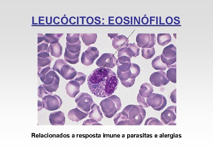 LEUCÓCITOS: EOSINÓFILOS LEUCÓCITOS: EOSINÓFILOS