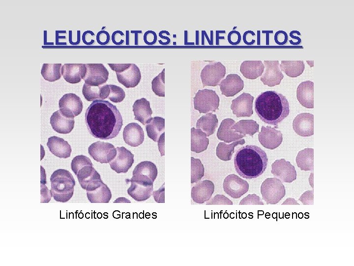 LEUCÓCITOS: LINFÓCITOS Linfócitos Grandes Linfócitos Pequenos LEUCÓCITOS: LINFÓCITOS Linfócitos Grandes Linfócitos Pequenos