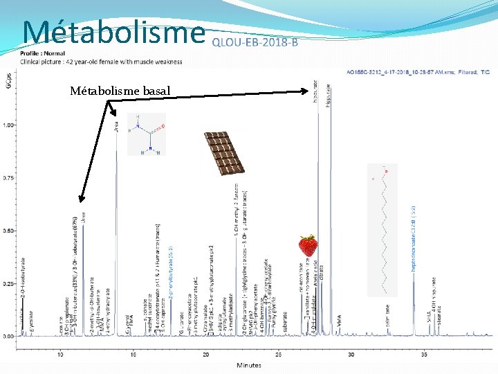 Métabolisme basal Métabolisme basal