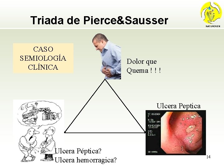 Triada de Pierce&Sausser CASO SEMIOLOGÍA CLÍNICA Dolor que Quema ! ! ! Ulcera Peptica